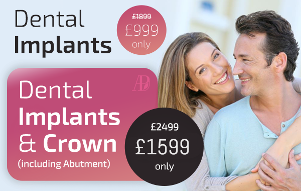 dental implants musewell hill